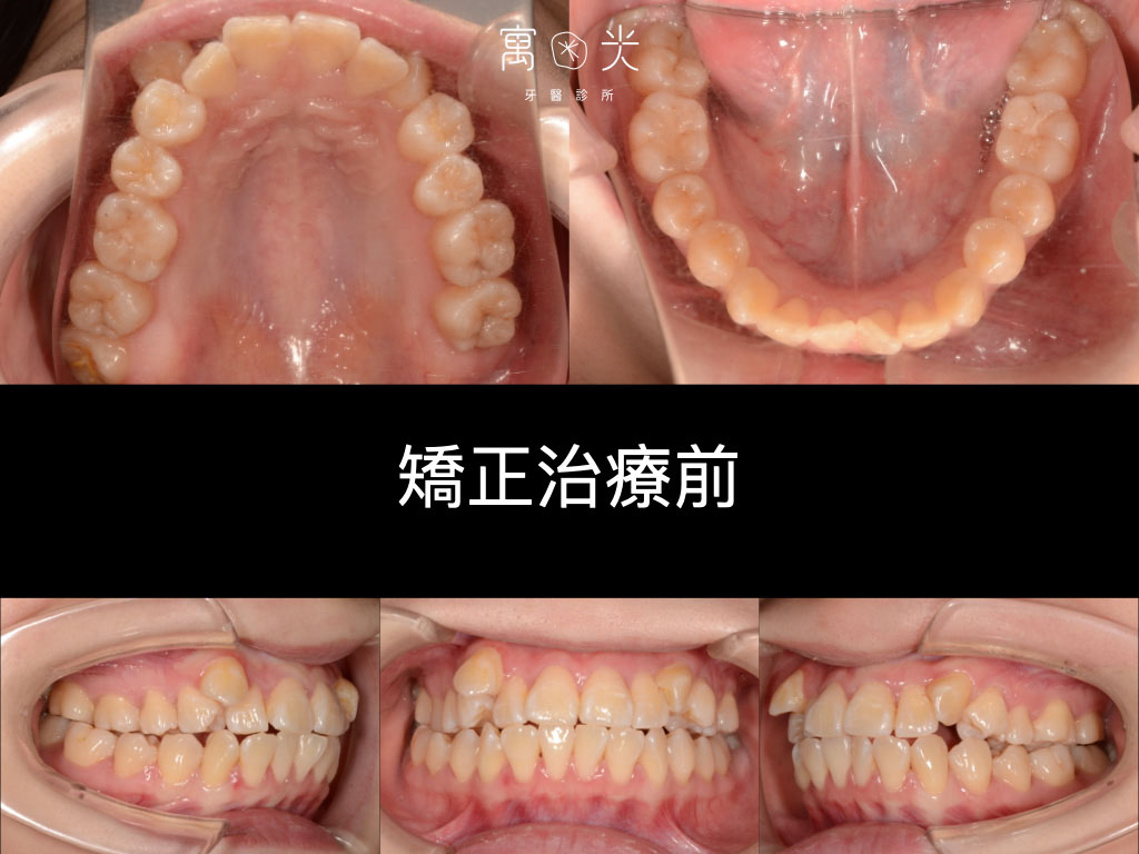 case correction 1 1 1