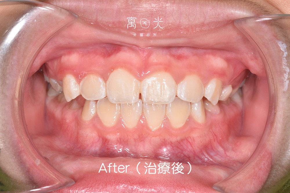 case correction 2 2 1